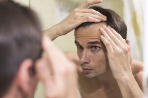 Os Melhores Tratamentos Médicos para a Queda de Cabelo em Homens